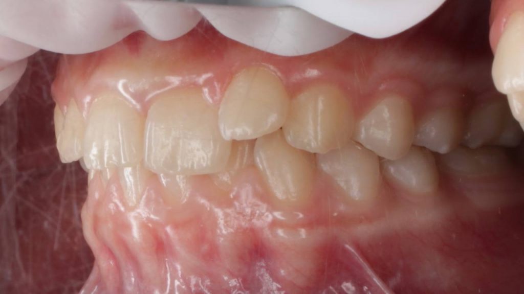 Портфолио - до 3